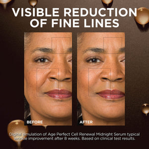 L'Oreal Paris Age Perfect Anti-Aging Midnight Face Serum, Reduce Wrinkles 1oz + Eye Cream Sample