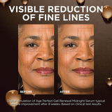 L'Oreal Paris Age Perfect Anti-Aging Midnight Face Serum, Reduce Wrinkles 1oz + Eye Cream Sample